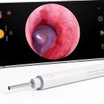 ScopeAround Otoscope 720P HD Ear Camera with 6 LED Lights SASA39i-0