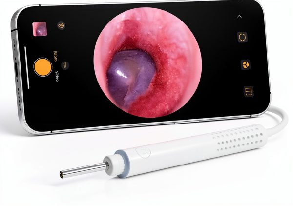 ScopeAround Otoscope 720P HD Ear Camera with 6 LED Lights SASA39i-0