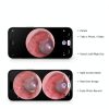 ScopeAround Otoscope Digital Ear Camera 1.85in IPS Screen 6 LED Lights-4