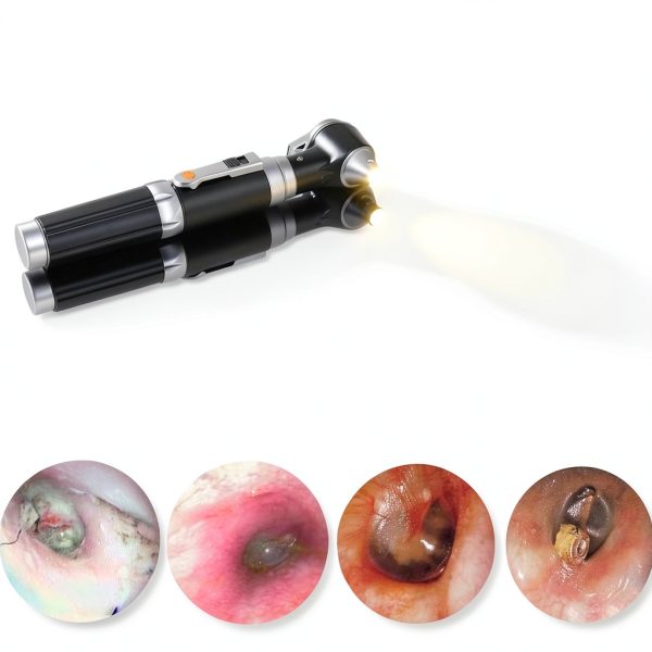 Mini Ear Otoscope Bysameyee 3X Magnifier LED Light with 4 Speculum-2