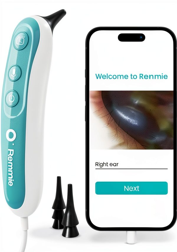 Remmie 4 AI-Powered Digital Otoscope with Light for Kids & Adults-0
