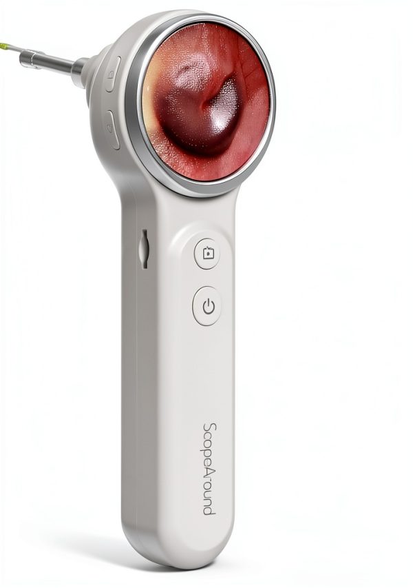 ScopeAround Otoscope Digital Ear Camera 1.85in IPS Screen 6 LED Lights-0