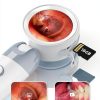 Digital Otoscope Camera with Light – HD Screen 90° Foldable Support Photo Video and PC View, Ear Infection Detector, Pocket Ear Scope with Earwax Removal Tool for Family Adults, Kids and Pets-5