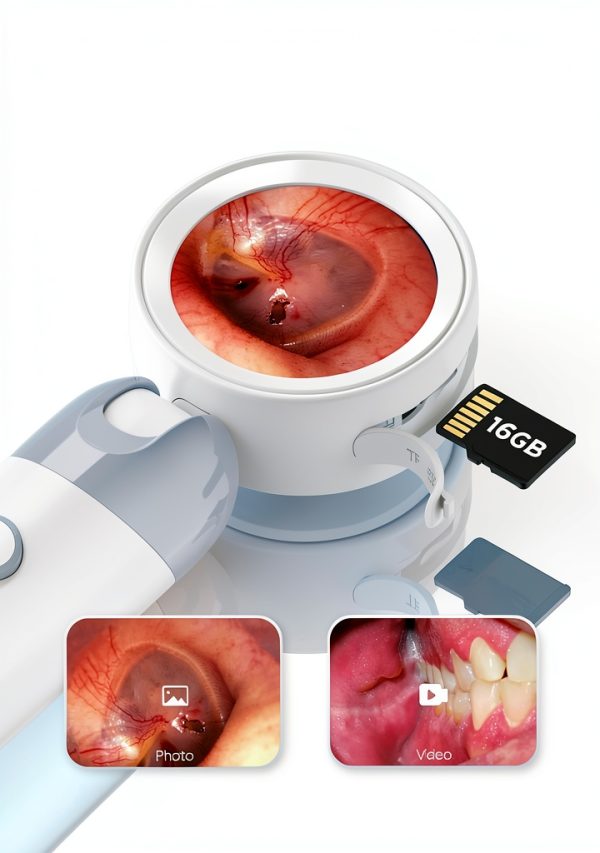 Digital Otoscope Camera with Light – HD Screen 90° Foldable Support Photo Video and PC View, Ear Infection Detector, Pocket Ear Scope with Earwax Removal Tool for Family Adults, Kids and Pets-5