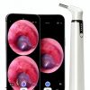ScopeAround Otoscope Dual View 720pHD WiFi Ear Scope 6 LED 3.9mm Lens-6