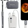 Digital Otoscope Teslong NTE100i 1080p HD Ear Camera with Light-0