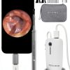 Digital Otoscope Teslong NTE100i 1080p HD Ear Camera with Light-8