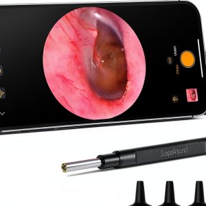 ScopeAround Otoscope with Light, 1080P FHD Ear Scope, 3.9mm Digital Otoscope Camera with 6 LED Lights Ear Wax Removal Tool Camera, Ear Scope with Light, Compatible with iPhone15 & Android-0