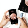 Qimic Wireless Otoscope Ear Camera - 1080P WiFi Otoscope with 6 LED Lights, Ear Scope Camera with 10 Colorful Accessories for Kids,Pets &Adults,Support Photo and Video, Compatible with Android-7