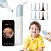 Qimic Wireless Otoscope Ear Camera - 1080P WiFi Otoscope with 6 LED Lights, Ear Scope Camera with 10 Colorful Accessories for Kids,Pets &Adults,Support Photo and Video, Compatible with Android-0