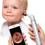 Wireless Otoscope ScopeAround 720P HD Camera 6 LED Lights Gyroscope-0