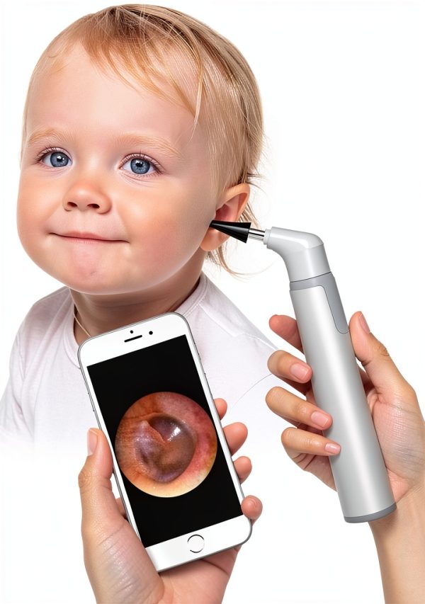 Wireless Otoscope ScopeAround 720P HD Camera 6 LED Lights Gyroscope-0