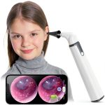 ScopeAround Otoscope Dual View 720pHD WiFi Ear Scope 6 LED 3.9mm Lens-0